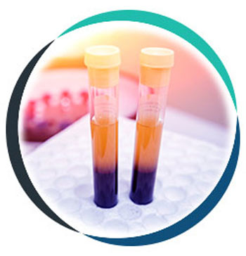 PRP Injections in Allen, TX