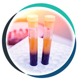 PRP Injections in Allen, TX