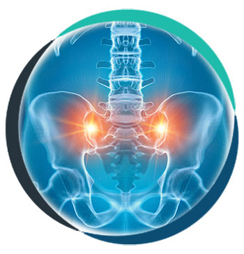 Sacroiliac Joint Pain in Allen TX