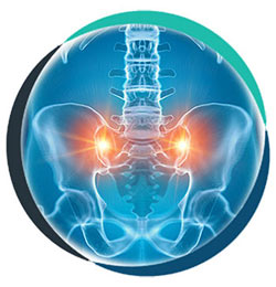 Sacroiliac Joint Pain in Allen TX