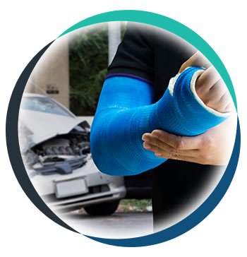 Auto Accident Injury in Allen TX