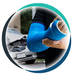 Auto Accident Injury in Allen TX