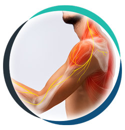 Nerve Pain in Allen, TX